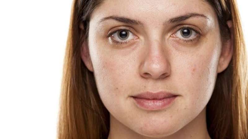 Why Your Skin Still Looks Tired (Even When You Sleep Well)